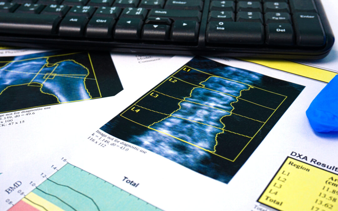 Understanding DXA Scan Radiation – Is It Safe?