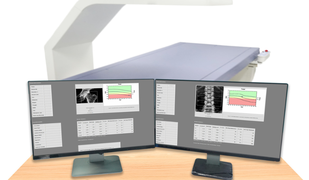 Understanding the DXA Scan Machine: A Guide by DXA Body Composition NC