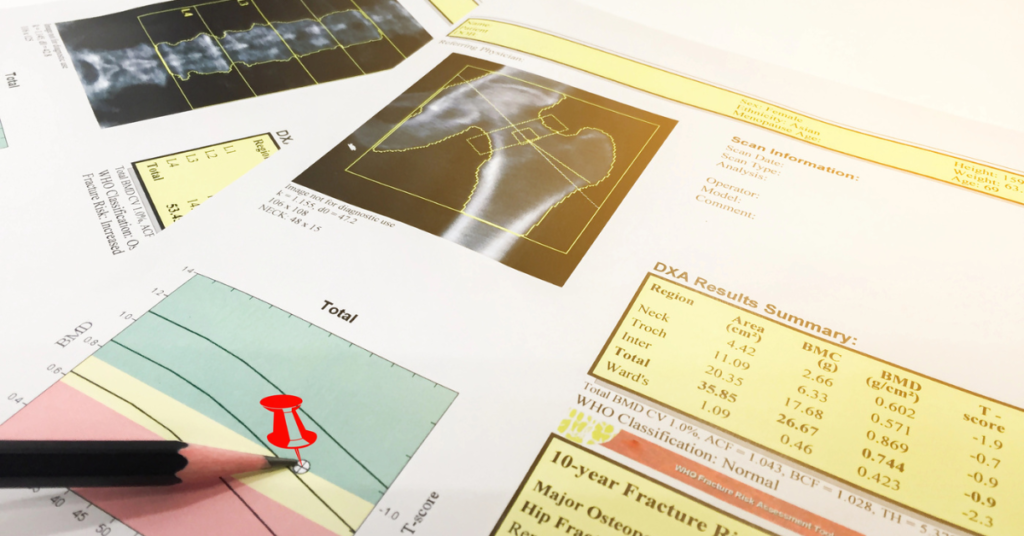 The Future of DEXA in Sports Medicine